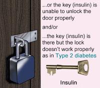 Type 2 Diabetes